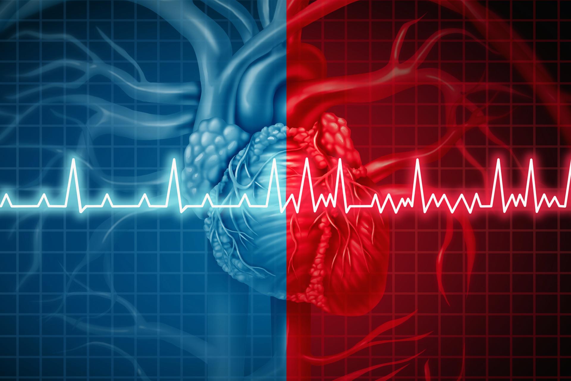 Smartwatch AI predicts atrial fibrillation 30 minutes before it arrives