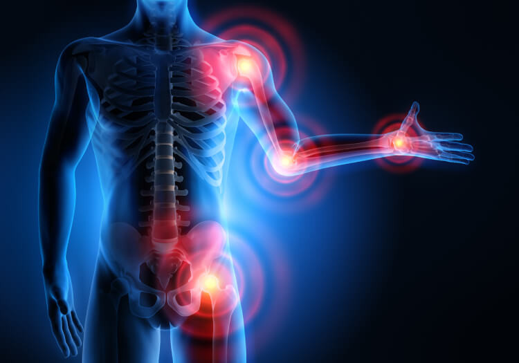 Machine Learning Predicts Osteoarthritis Risk Effectively