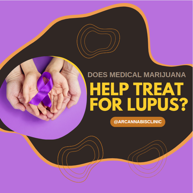 Does Medical Marijuana Help Treat For Lupus?