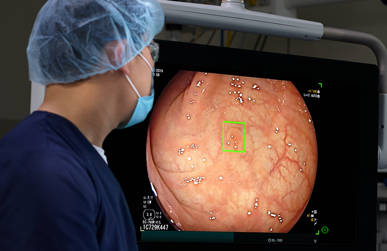 How Cosmo cranked up the cancer-catching AI behind Medtronic’s GI Genius ColonPro