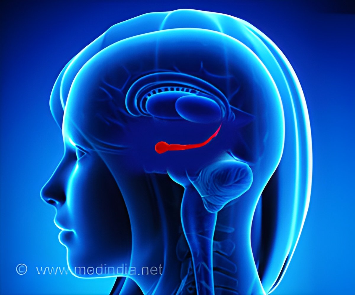 How Machine Learning Transforms Functional Neurological Disorder Classification?