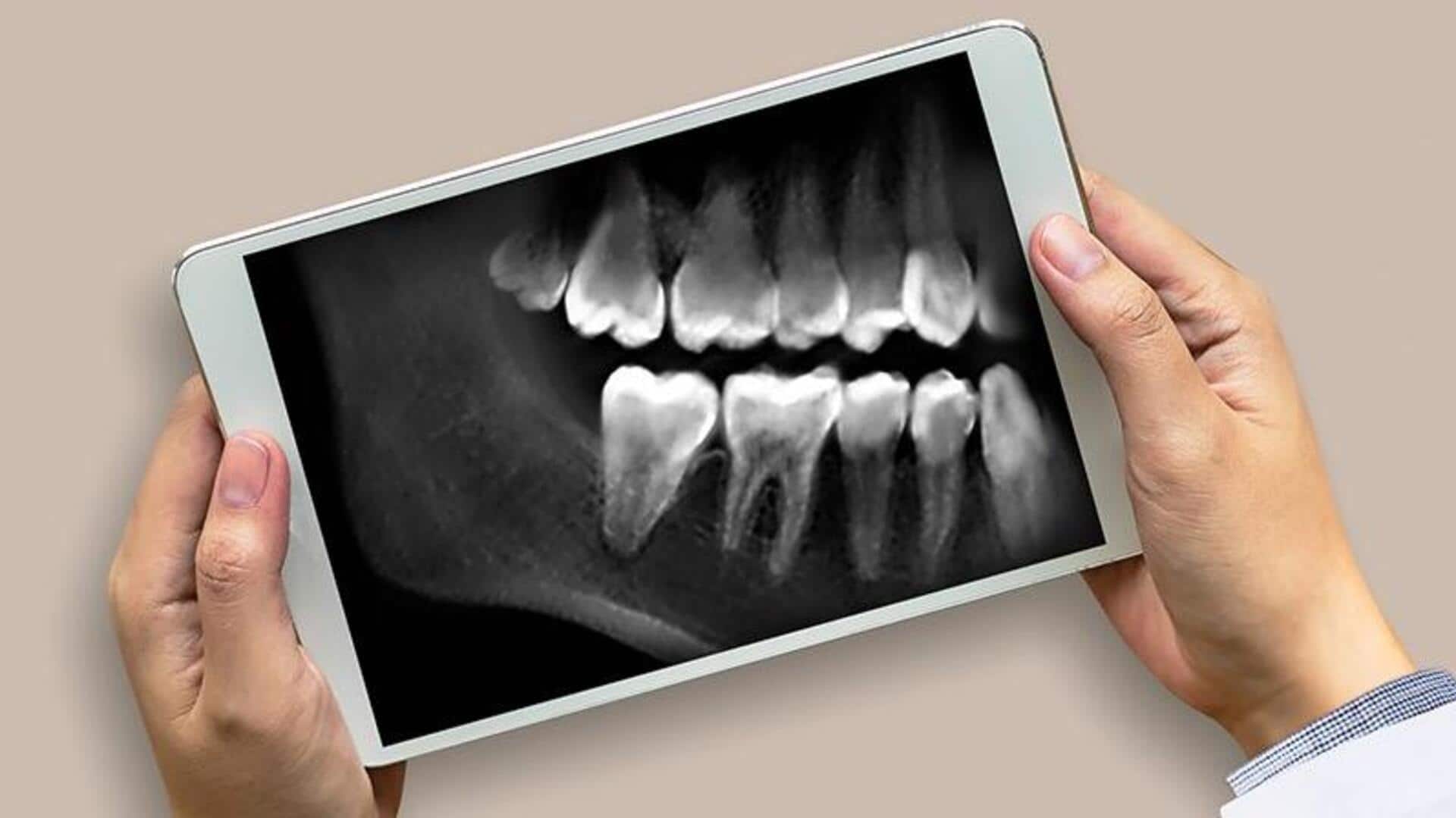 New AI tool can identify sex using dental X-rays