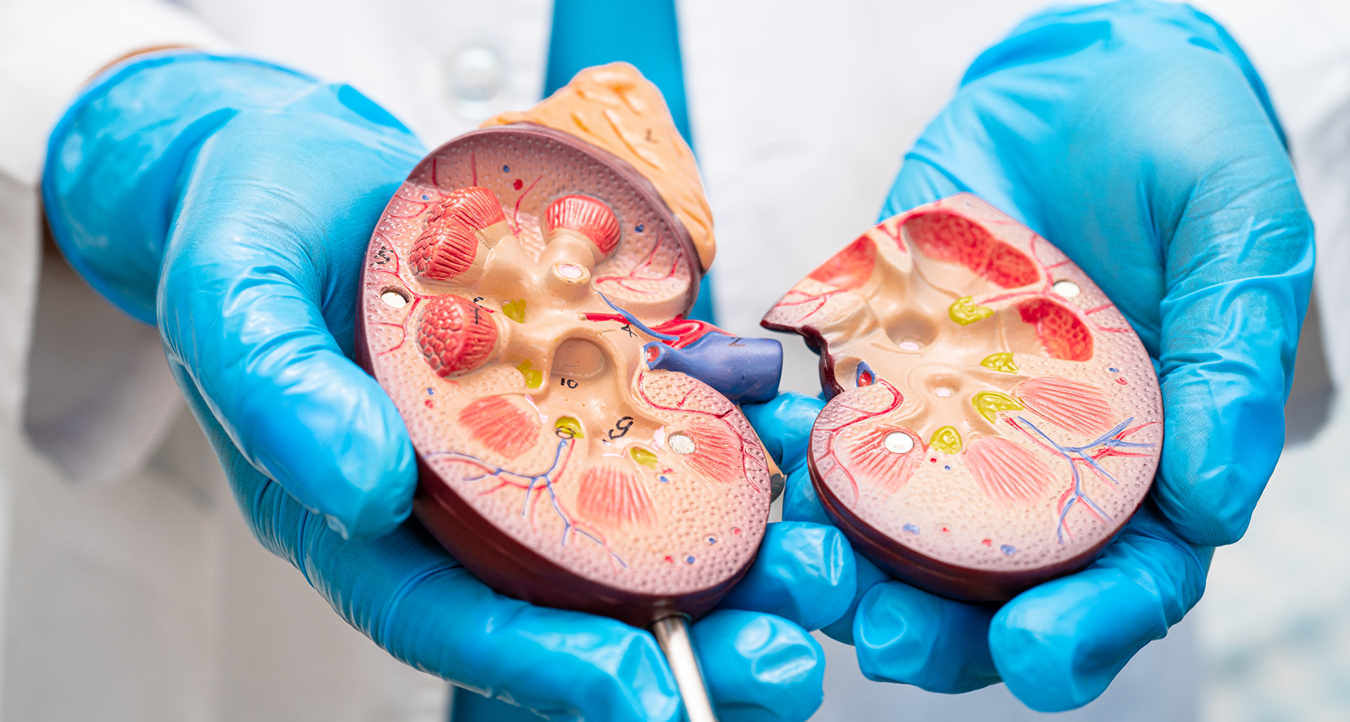 VA to review service link between PFAS exposure and kidney cancer