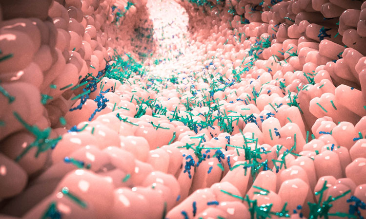 How chronic stress hastens the progression of colorectal cancer