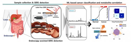 Light-AI technology opens the door to early cancer diagnosis