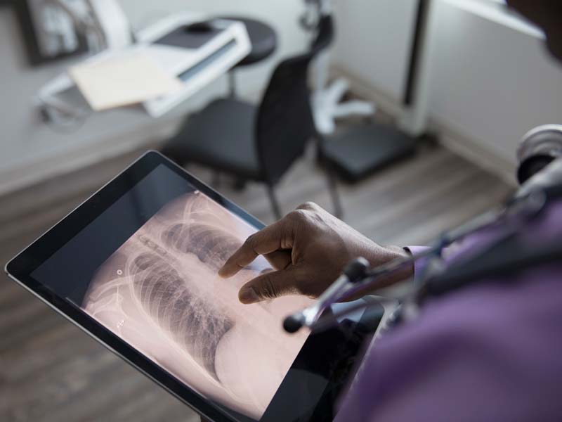 Teladoc Health launches AI motion detection solution to improve patient safety in hospital beds