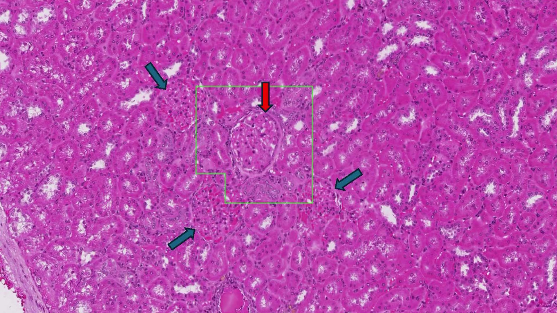 'Truly can be done in minutes': AI model spots signs of cancer, gene problems