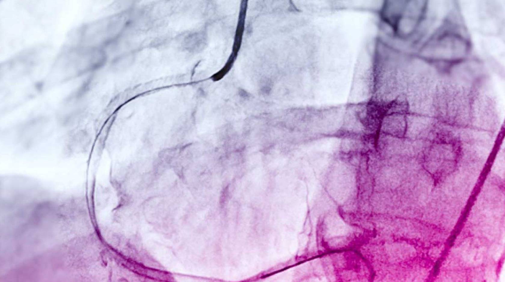 4 ways artificial intelligence is poised to transform medicine