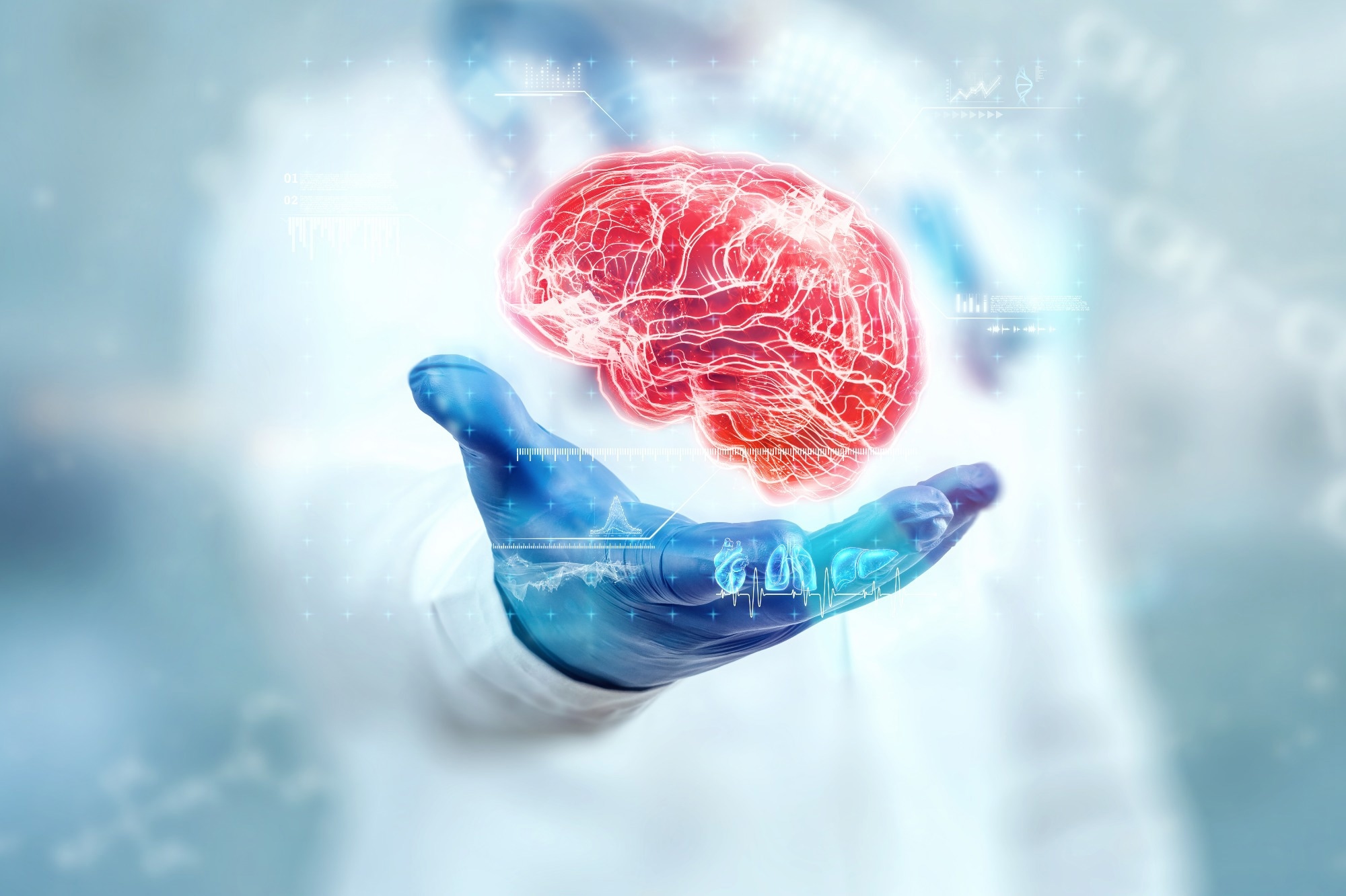 Alzheimer’s disease may leave early signs in the gut, study finds