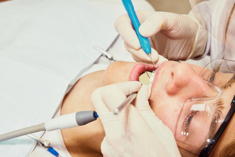 Cannabis smoking can cause cavities, severe tooth loss