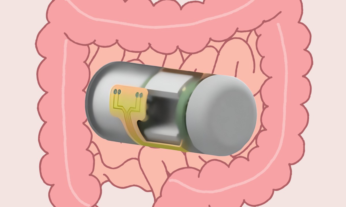 This ingestible smart capsule can wirelessly monitor gut health in real time